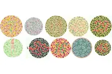 Mavi Renk Körlüğü Belirtileri ve Tedavisi