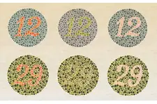 Tam Renk Körlüğü Belirtileri ve Tedavisi Tam Renk Körlüğü Belirtileri ve Tedavisi