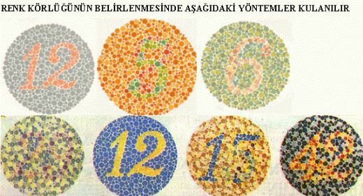 Renk Körlüğü Ameliyatı Riskleri ve Sonrası