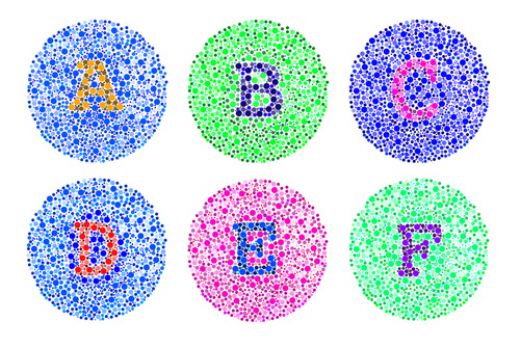 Renk Körlüğü Dereceleri Renk Körlüğü Teşhisi ve Tedavisi